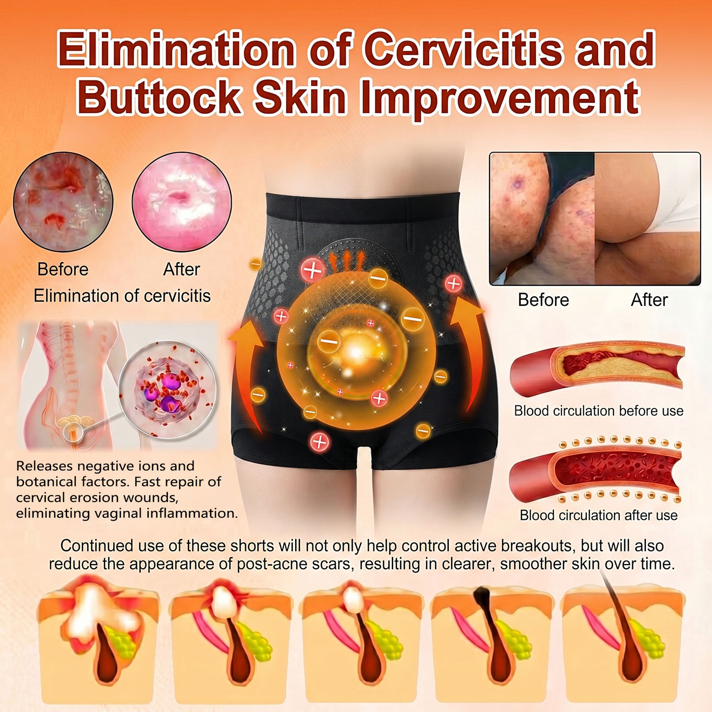 SilkVesper® 🌼💖30-Min All-in-One Micro-Particle Fat-Burning Shorts✅Ignites deep microcirculation to melt fat, flush toxins, and reverse metabolic aging.