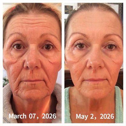 SilkVesper® Botin & Vita-A Retinol Shot