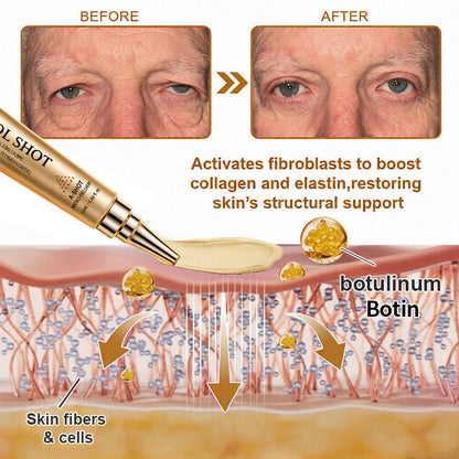 🧠👨‍⚕️Made and shipped from the USA 💫SilkVesper® Botin & Vita-A Retinol Shot Wrinkle-Lift Tightening cream - Last Day Promotion 70% OFF