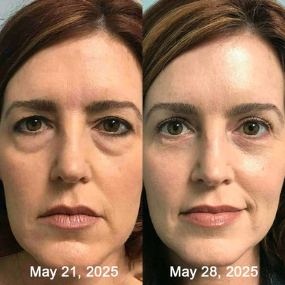 SilkVesper® Botin & Vita-A Retinol Shot